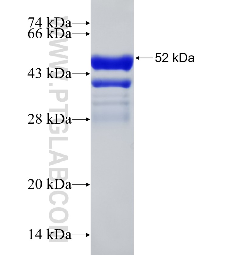 CCDC123 fusion protein Ag32789 SDS-PAGE