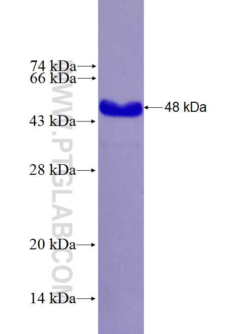 CCDC132 fusion protein Ag27016 SDS-PAGE