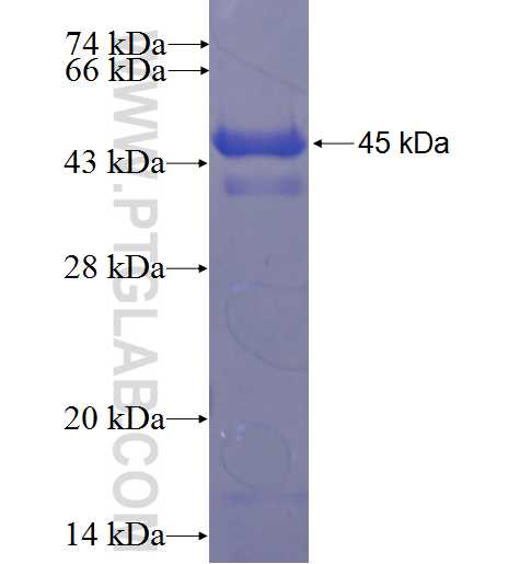 CCDC135 fusion protein Ag23635 SDS-PAGE