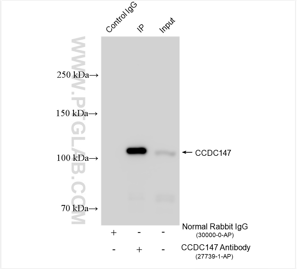 Immunoprecipitation (IP) experiment of mouse testis tissue using CCDC147 Polyclonal antibody (27739-1-AP)