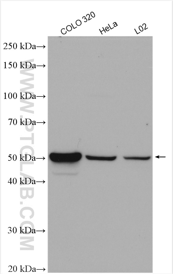 Western Blot (WB) analysis of various lysates using CCDC153 Polyclonal antibody (21390-1-AP)