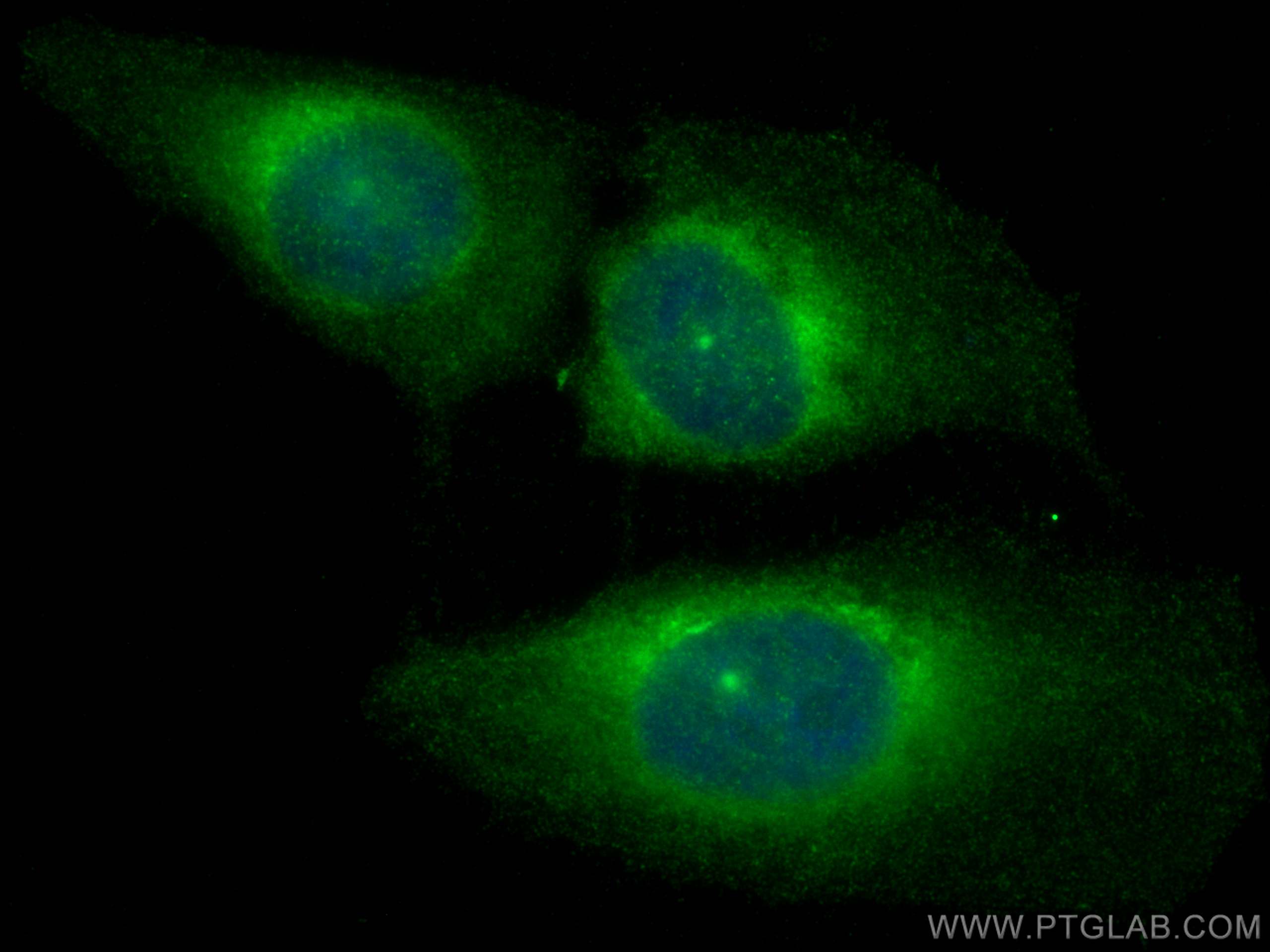 Immunofluorescence (IF) / fluorescent staining of U2OS cells using CCDC18 Polyclonal antibody (30024-1-AP)