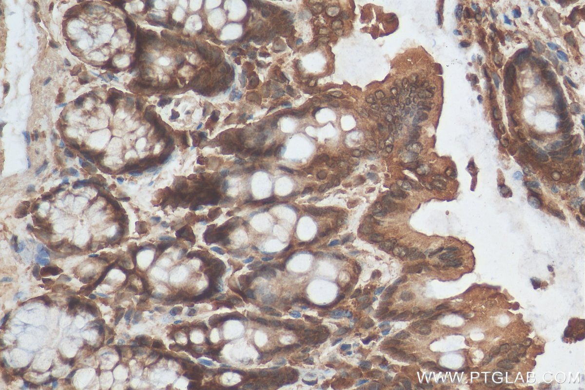 Immunohistochemistry (IHC) staining of rat colon tissue using CCDC18 Polyclonal antibody (30024-1-AP)