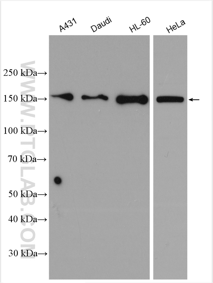 Western Blot (WB) analysis of various lysates using CCDC18 Polyclonal antibody (30024-1-AP)