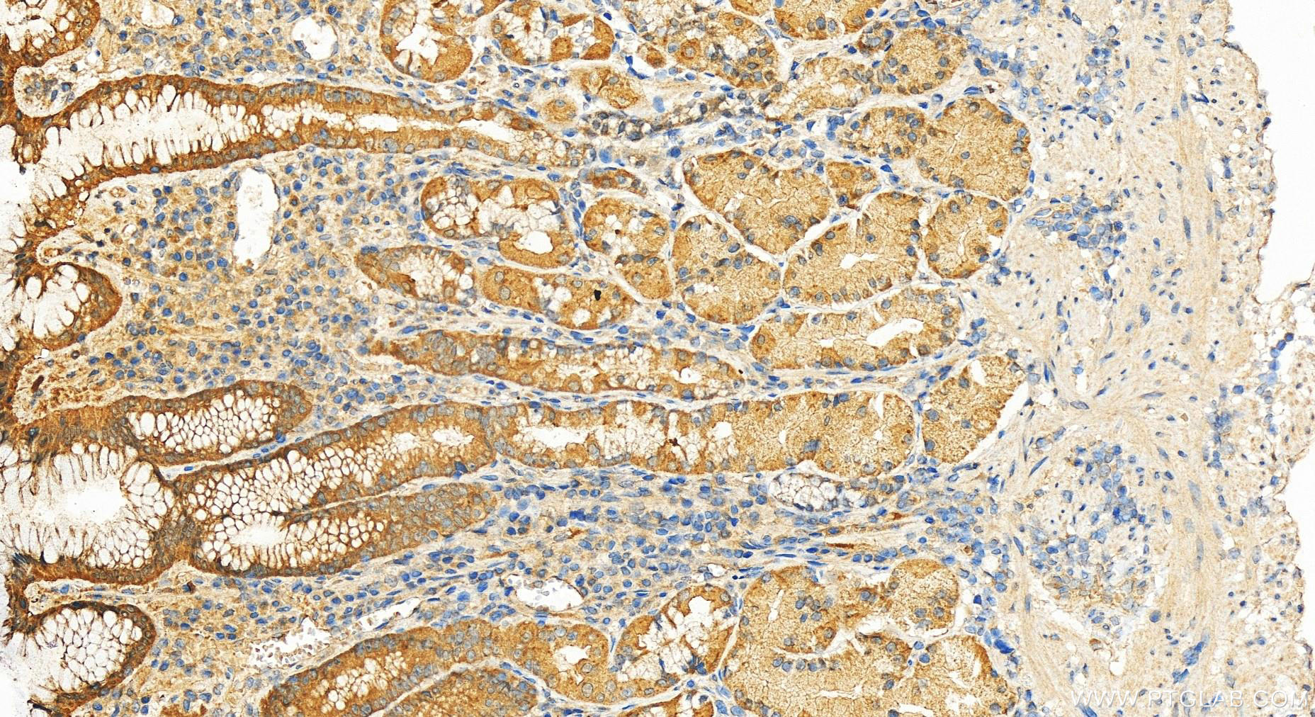 Immunohistochemistry (IHC) staining of human stomach tissue using CCDC25 Polyclonal antibody (21209-1-AP)