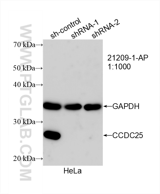 Western Blot (WB) analysis of HeLa cells using CCDC25 Polyclonal antibody (21209-1-AP)