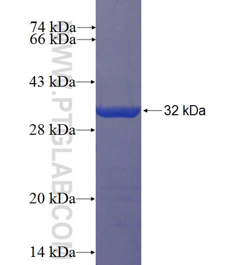 CCDC33 fusion protein Ag22881 SDS-PAGE