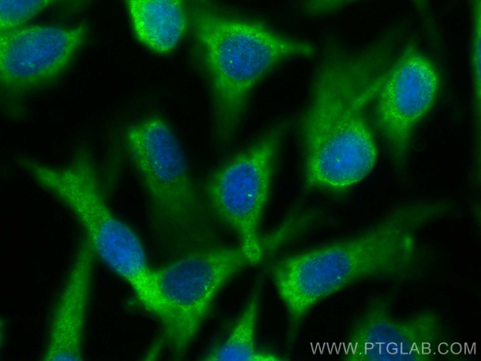 Immunofluorescence (IF) / fluorescent staining of MDCK cells using CEP112 Polyclonal antibody (24928-1-AP)