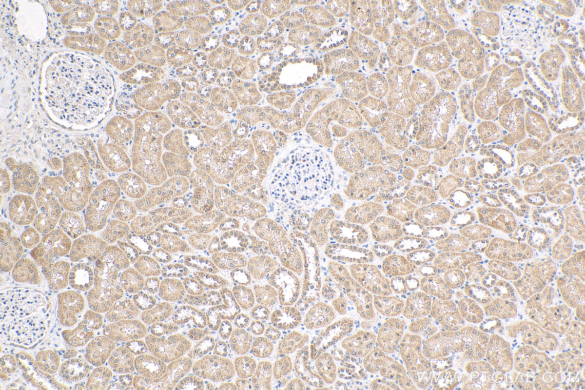 Immunohistochemistry (IHC) staining of human kidney tissue using CWC25 Polyclonal antibody (24416-1-AP)