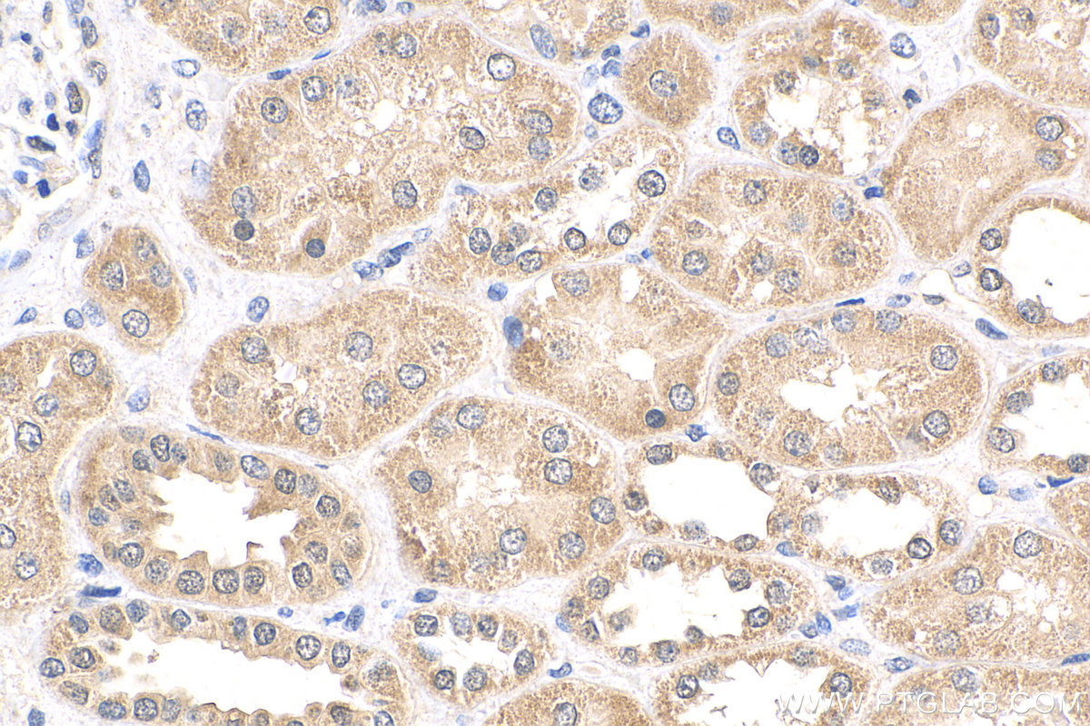 Immunohistochemistry (IHC) staining of human kidney tissue using CWC25 Polyclonal antibody (24416-1-AP)