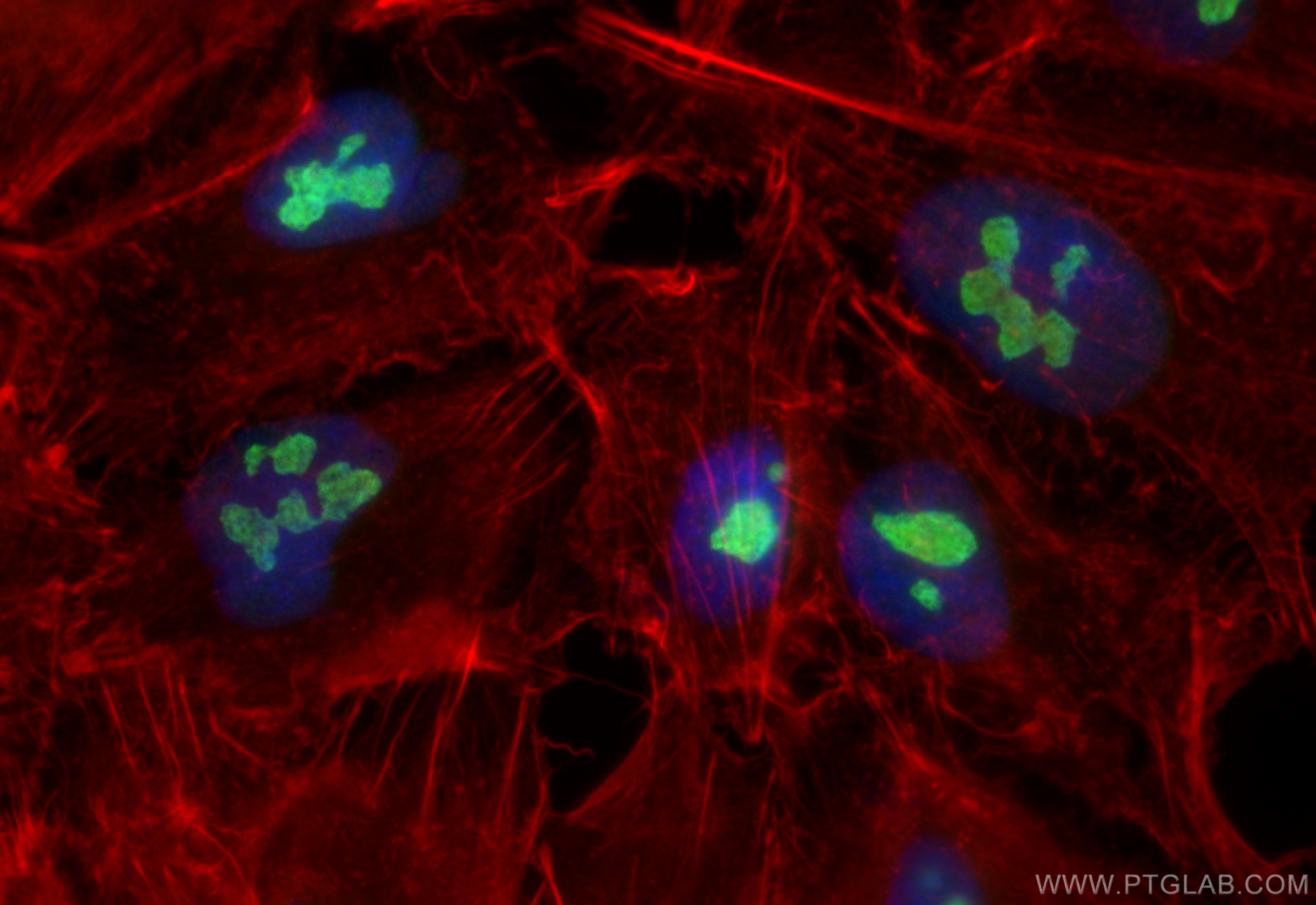 Immunofluorescence (IF) / fluorescent staining of A549 cells using Cyclon/CCDC86 Polyclonal antibody (14947-1-AP)