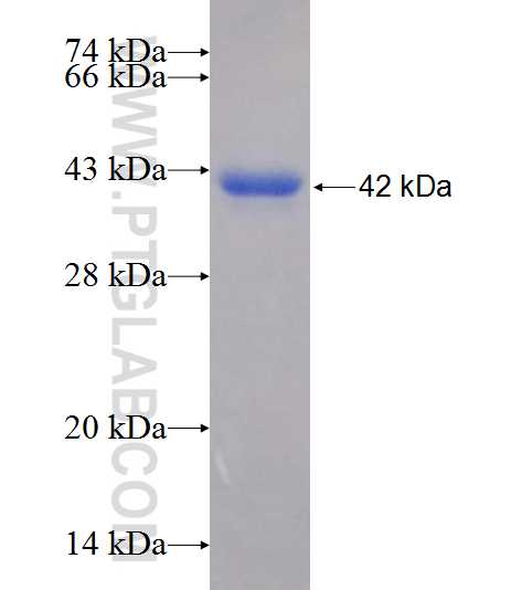 CCDC92 fusion protein Ag25624 SDS-PAGE