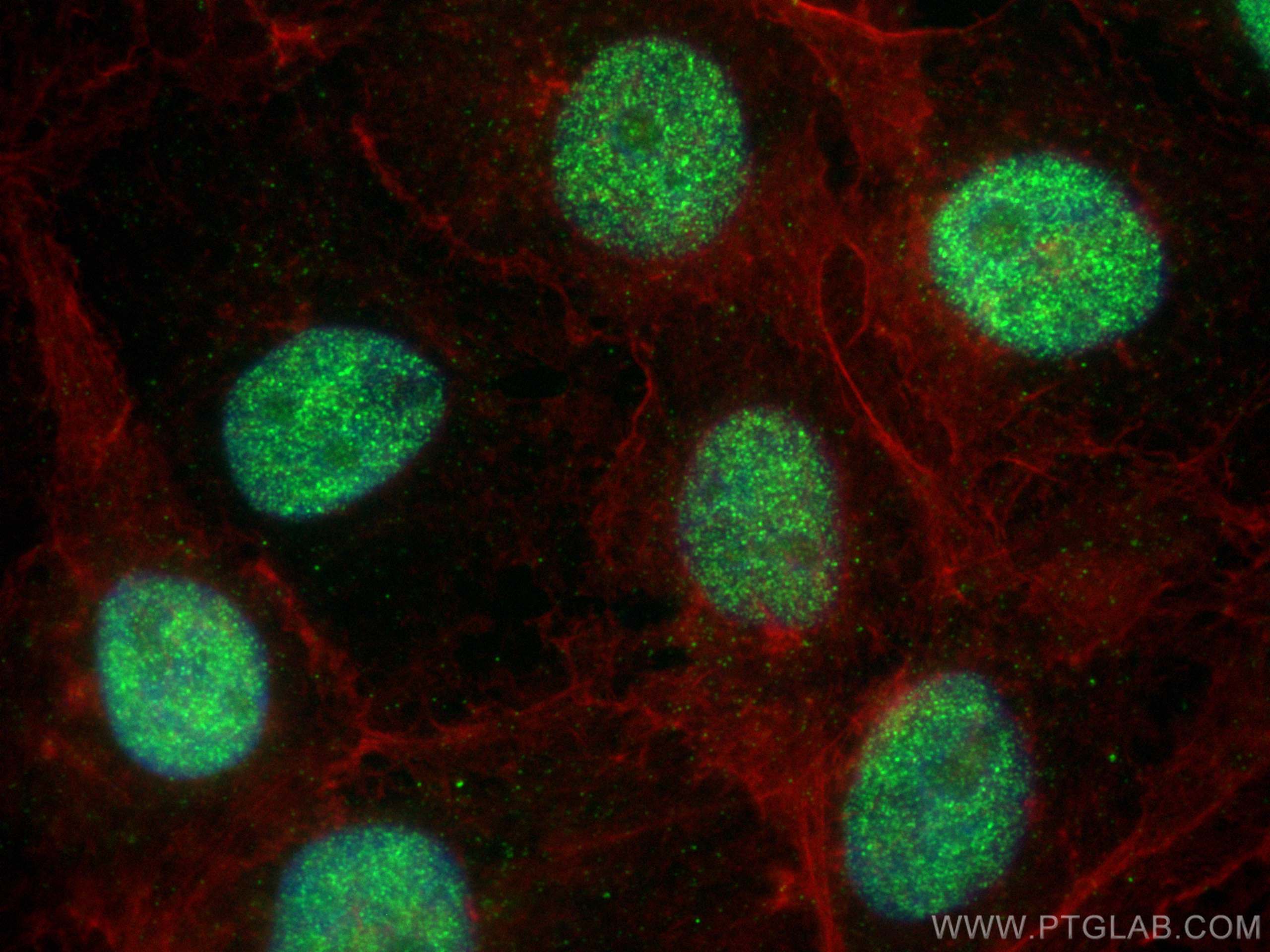 Immunofluorescence (IF) / fluorescent staining of A431 cells using CCDC94 Monoclonal antibody (68324-1-Ig)