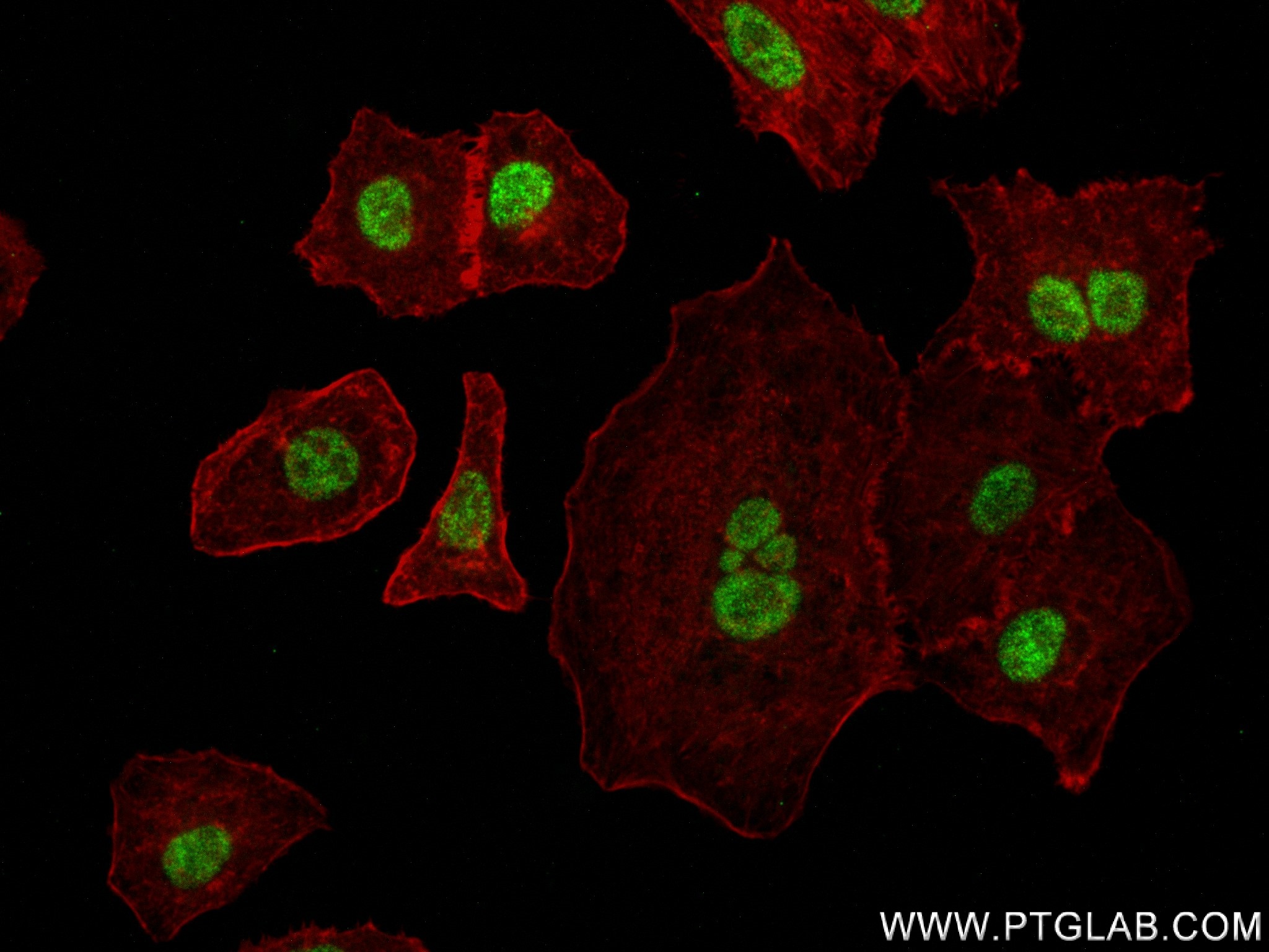 Immunofluorescence (IF) / fluorescent staining of A549 cells using CCDC94 Recombinant antibody (83580-1-RR)