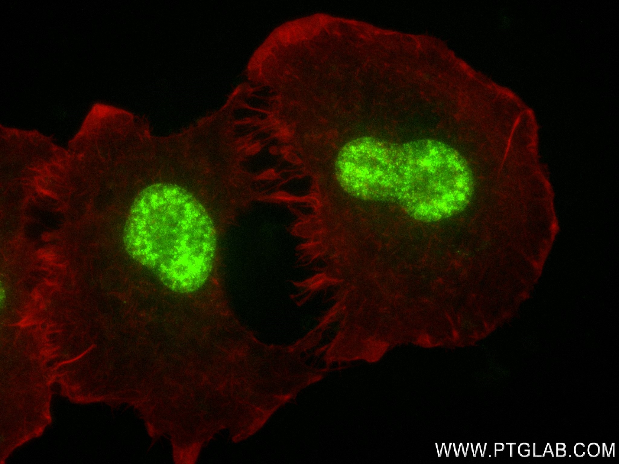 Immunofluorescence (IF) / fluorescent staining of A549 cells using CCDC94 Recombinant antibody (83580-1-RR)