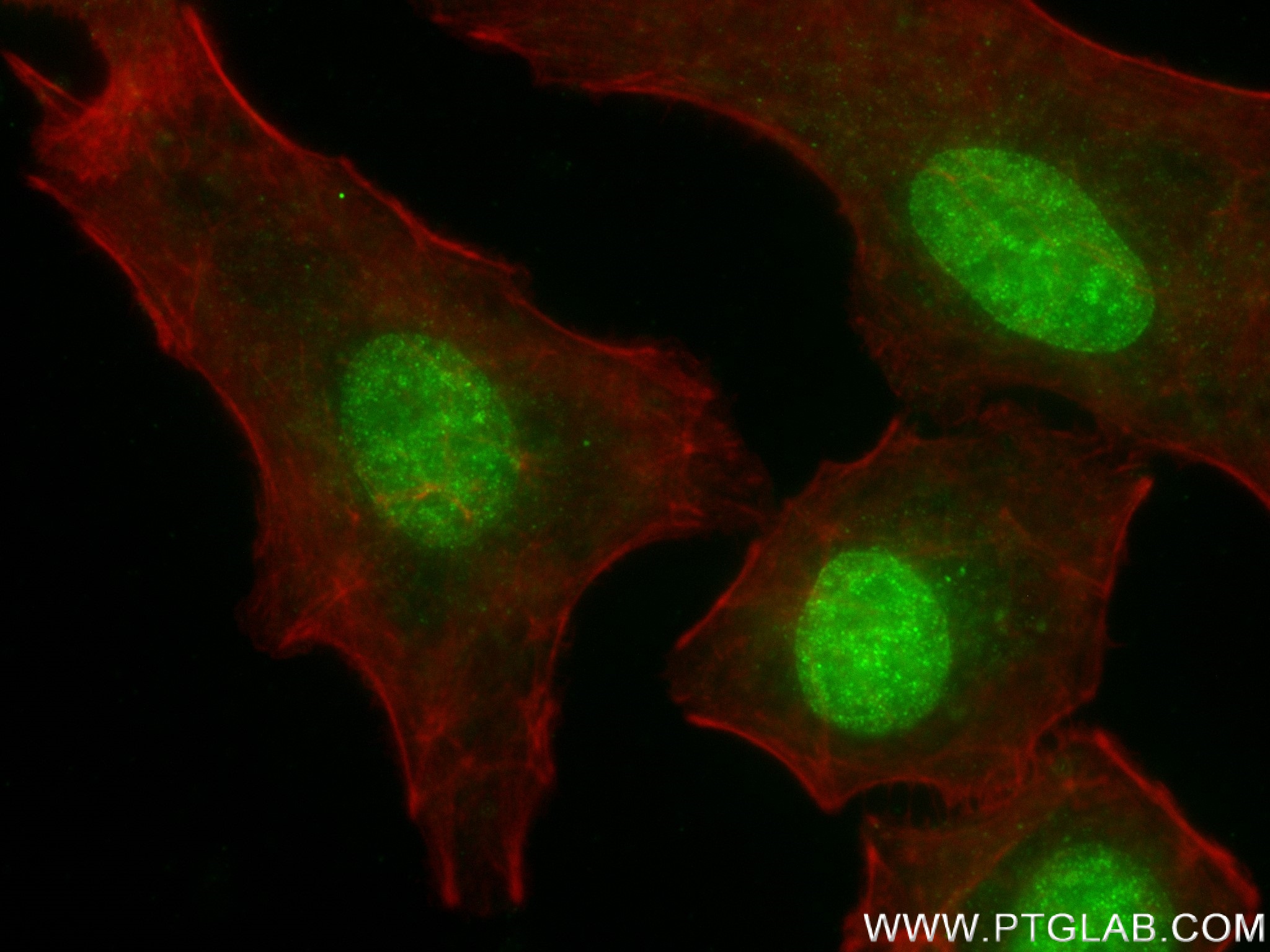 Immunofluorescence (IF) / fluorescent staining of A549 cells using CCDC94 Recombinant antibody (83580-5-RR)