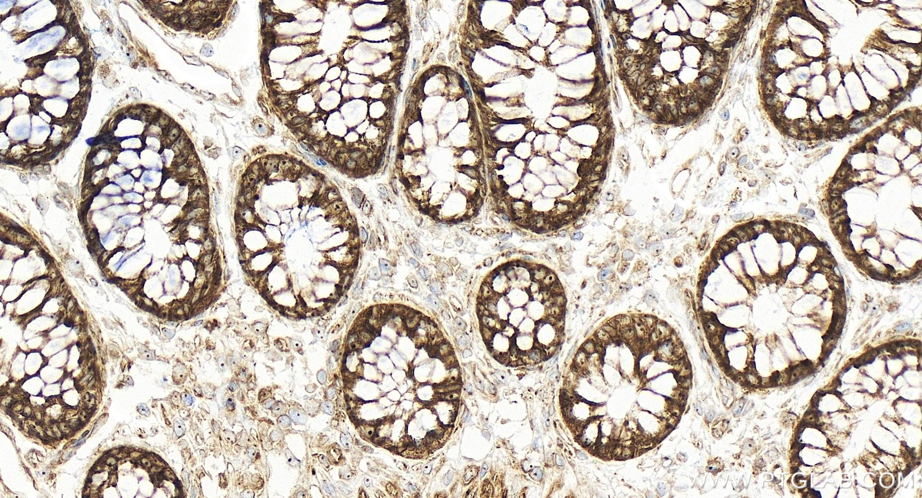 Immunohistochemistry (IHC) staining of human colon tissue using CCL20/MIP-3 alpha Recombinant antibody (84413-3-RR)