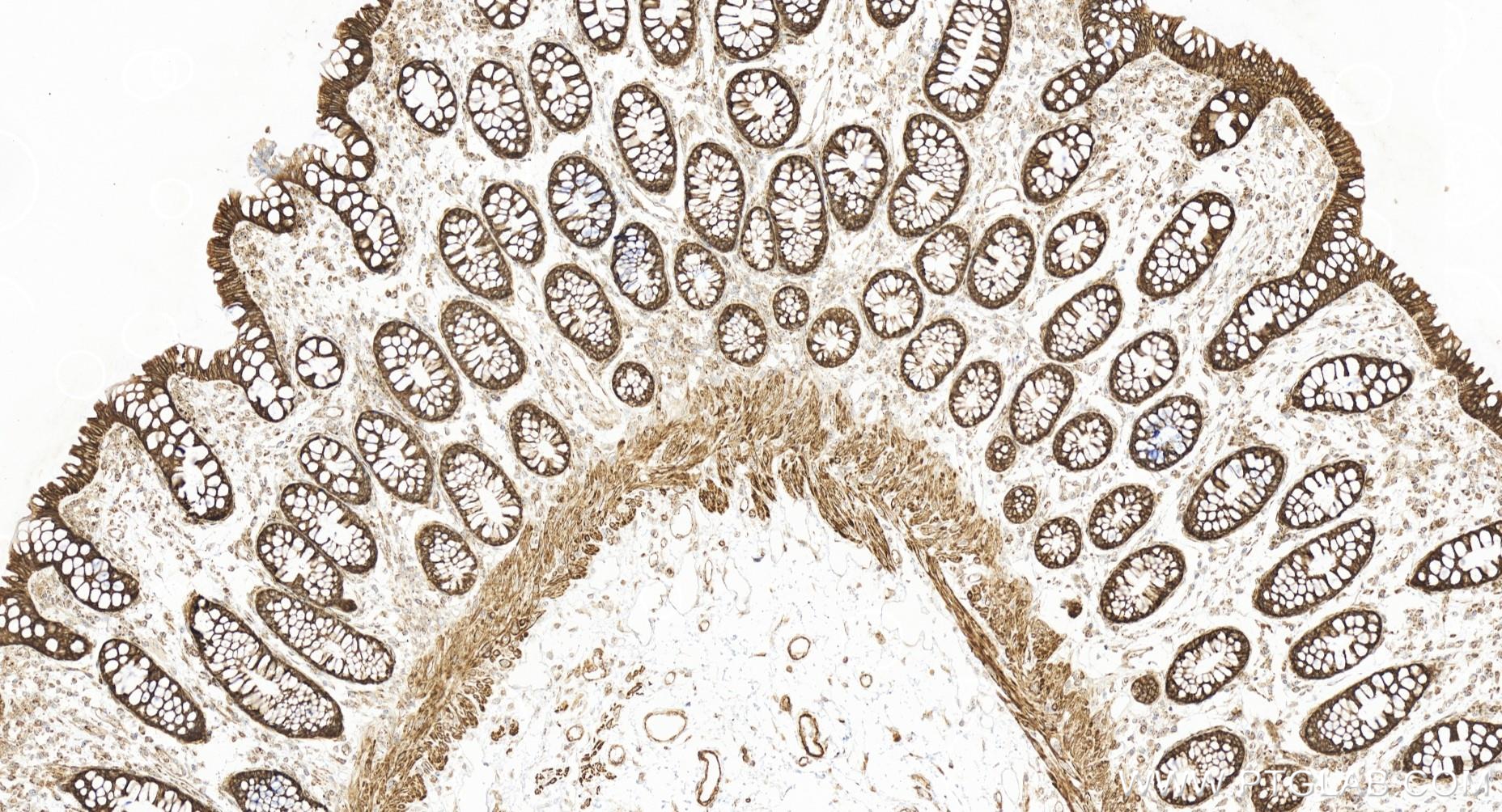 Immunohistochemistry (IHC) staining of human colon tissue using CCL20/MIP-3 alpha Recombinant antibody (84413-3-RR)