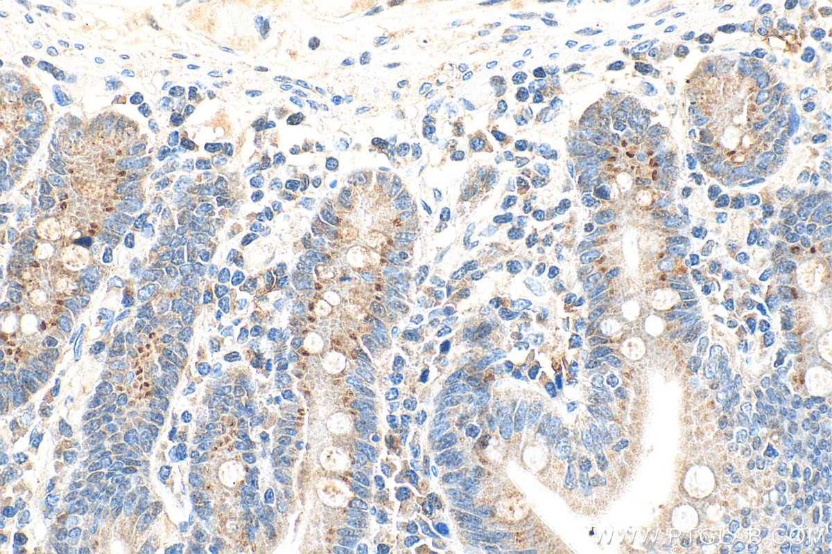Immunohistochemistry (IHC) staining of human small intestine tissue using CCL25/TECK Polyclonal antibody (25285-1-AP)