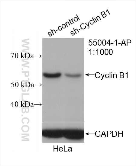 https://www.ptglab.com/products/pictures/CCNB1-Antibody-55004-1-AP-WB-428015.jpg