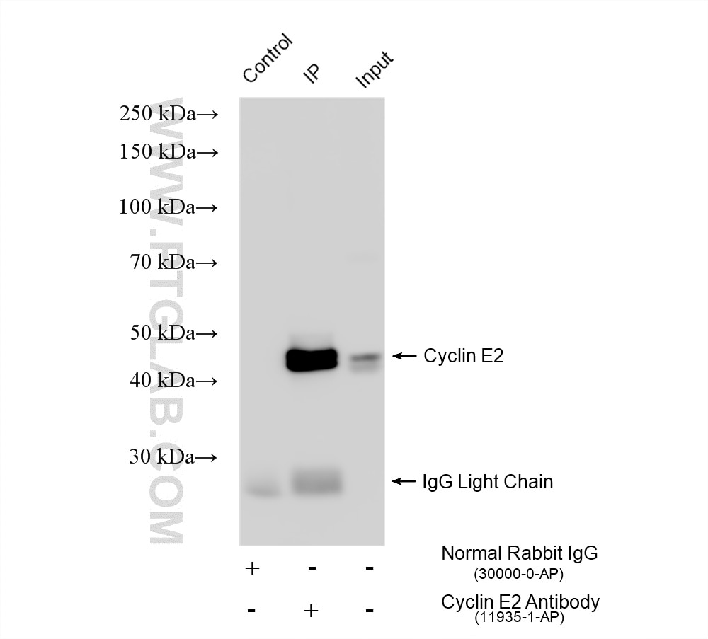 Immunoprecipitation (IP) experiment of Jurkat cells using Cyclin E2 Polyclonal antibody (11935-1-AP)