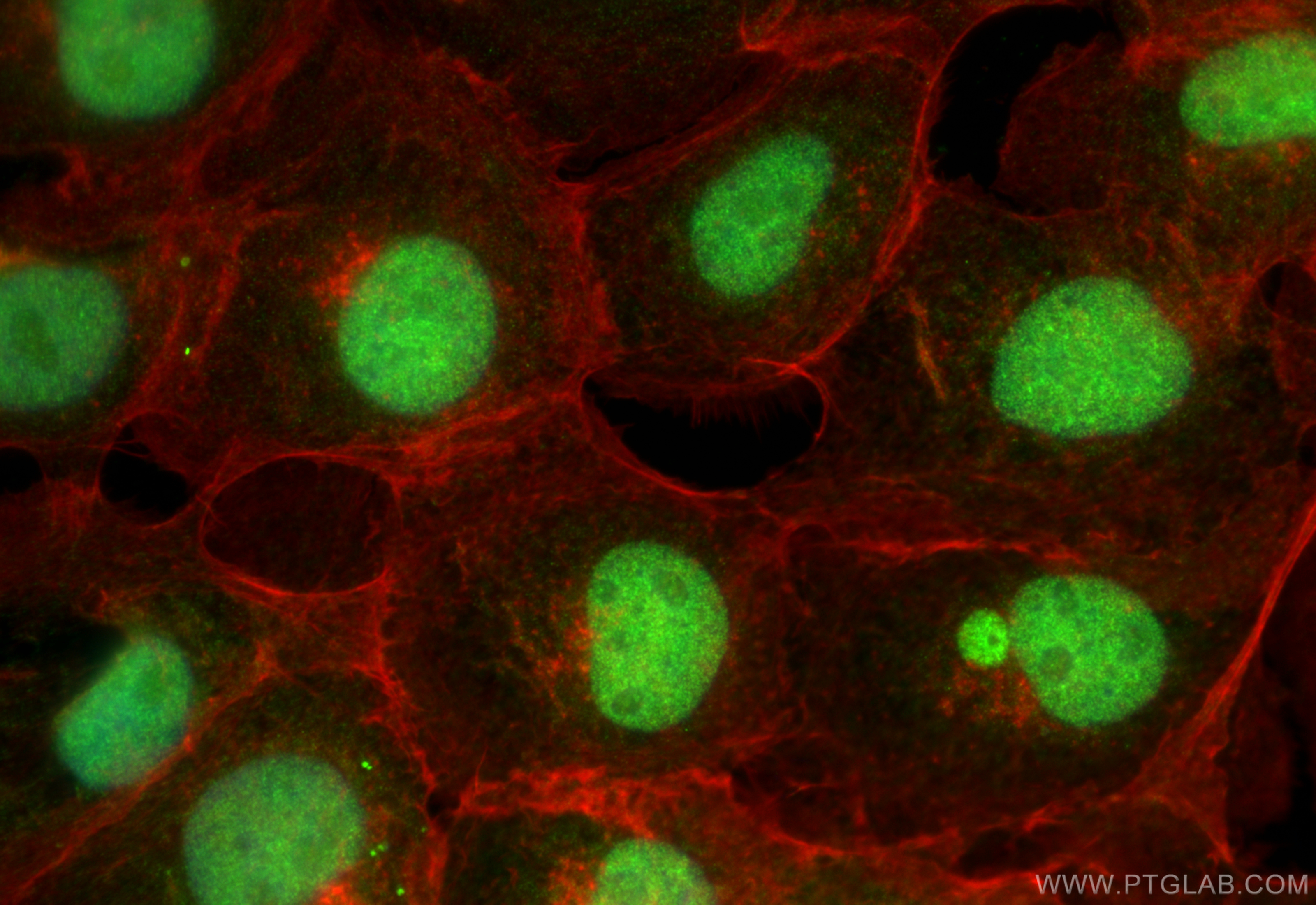 Immunofluorescence (IF) / fluorescent staining of A431 cells using Cyclin H Polyclonal antibody (10718-1-AP)