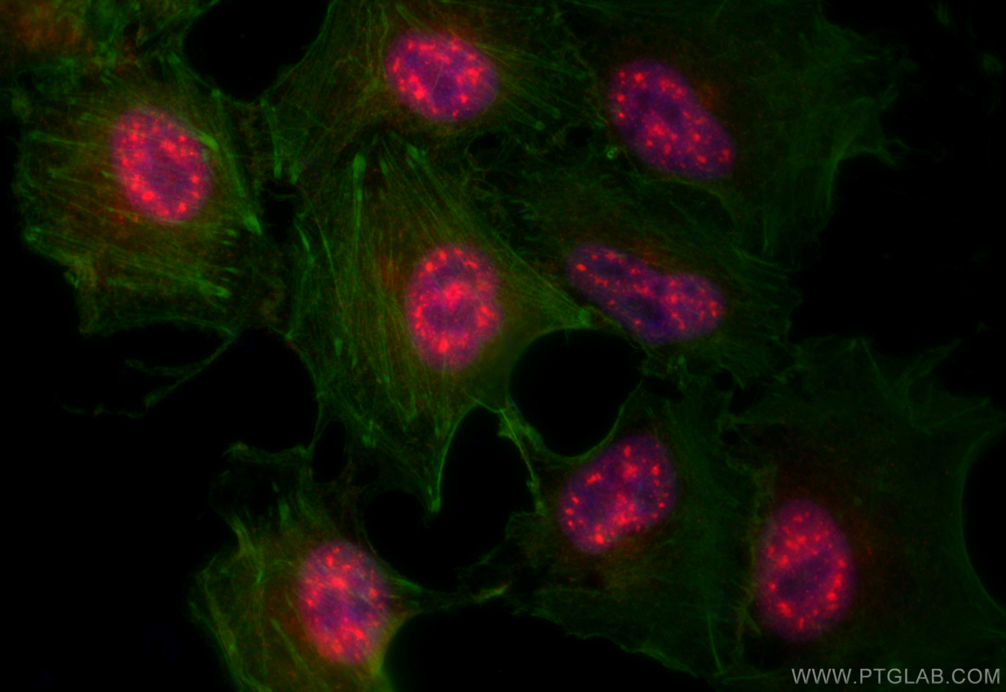 Immunofluorescence (IF) / fluorescent staining of A549 cells using CCNY Polyclonal antibody (18042-1-AP)