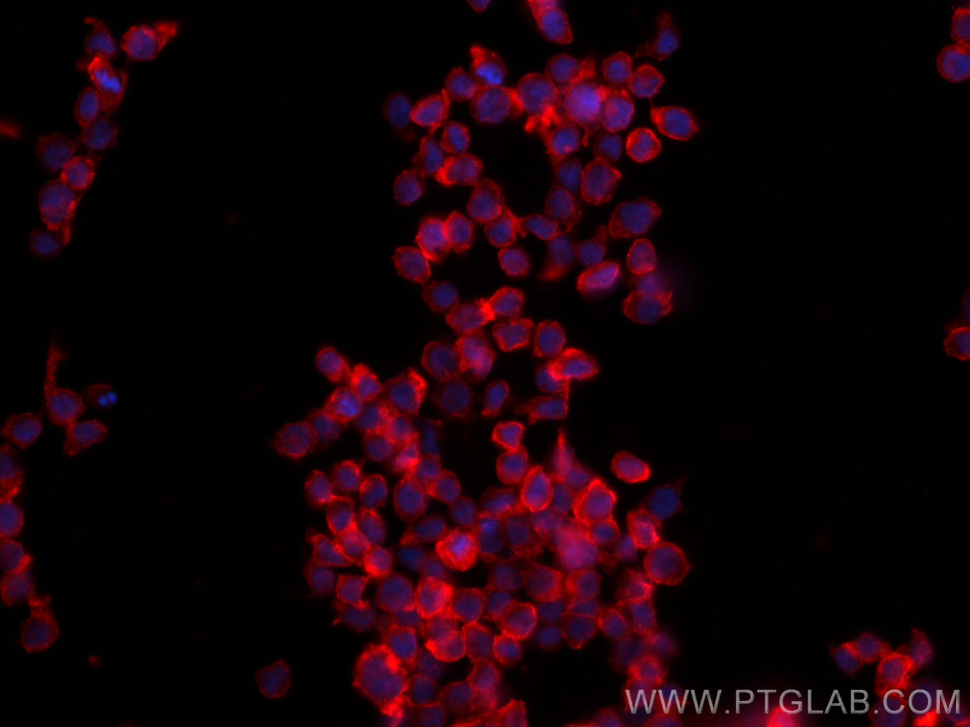 Immunofluorescence (IF) / fluorescent staining of THP-1 cells using CCR2 Polyclonal antibody (30420-1-AP)
