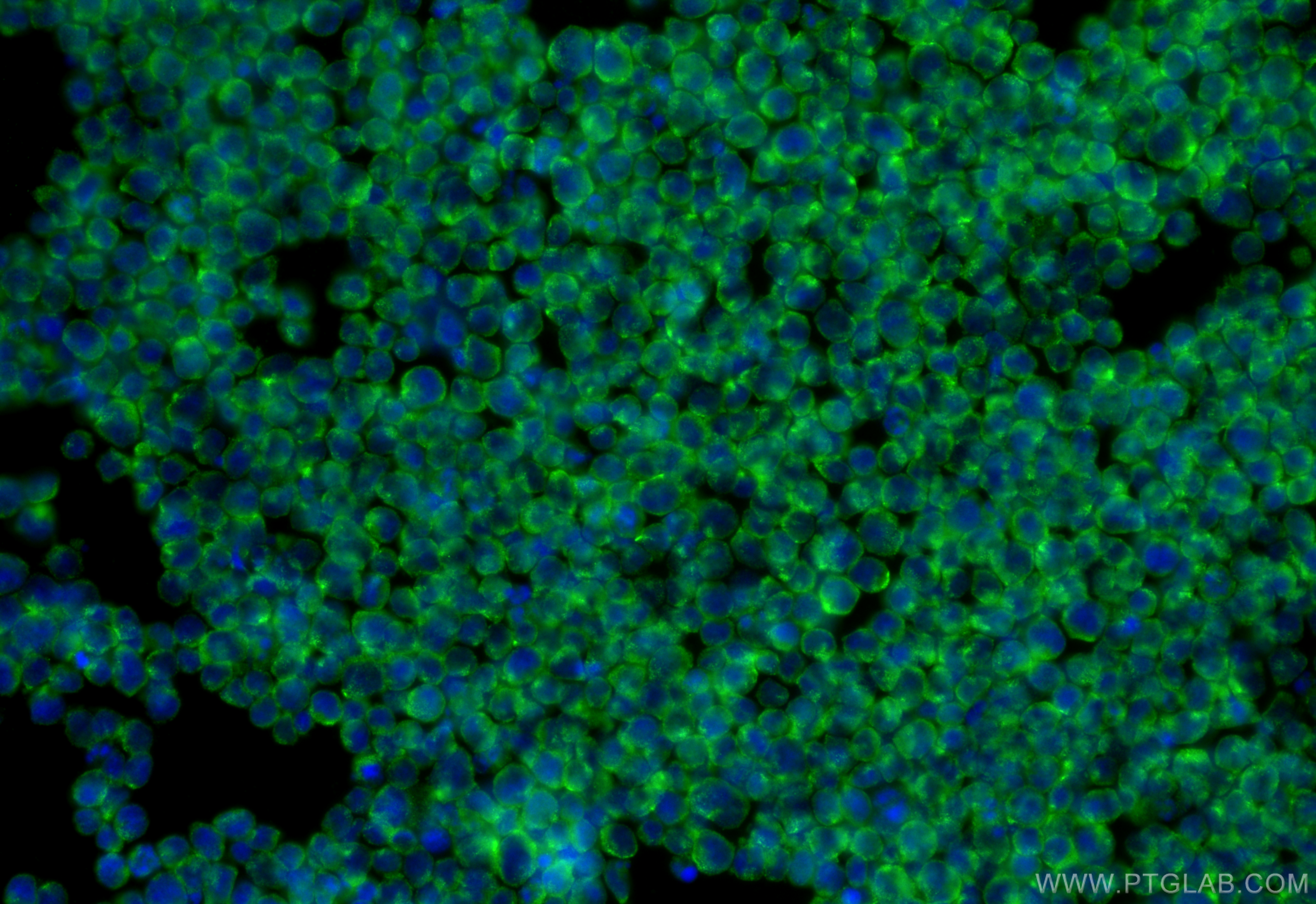 Immunofluorescence (IF) / fluorescent staining of Jurkat cells using CCR2a-specific Polyclonal antibody (16153-1-AP)