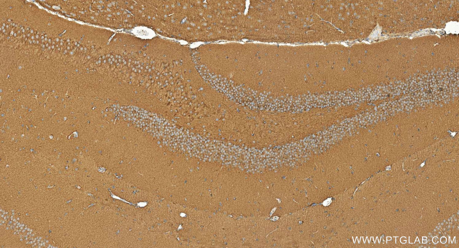 Immunohistochemistry (IHC) staining of mouse brain tissue using CCR2a-specific Polyclonal antibody (16153-1-AP)