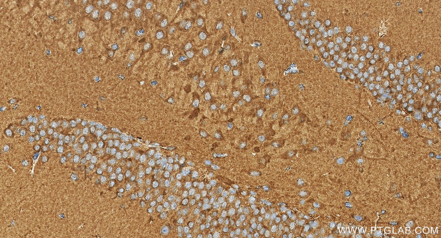 Immunohistochemistry (IHC) staining of mouse brain tissue using CCR2a-specific Polyclonal antibody (16153-1-AP)