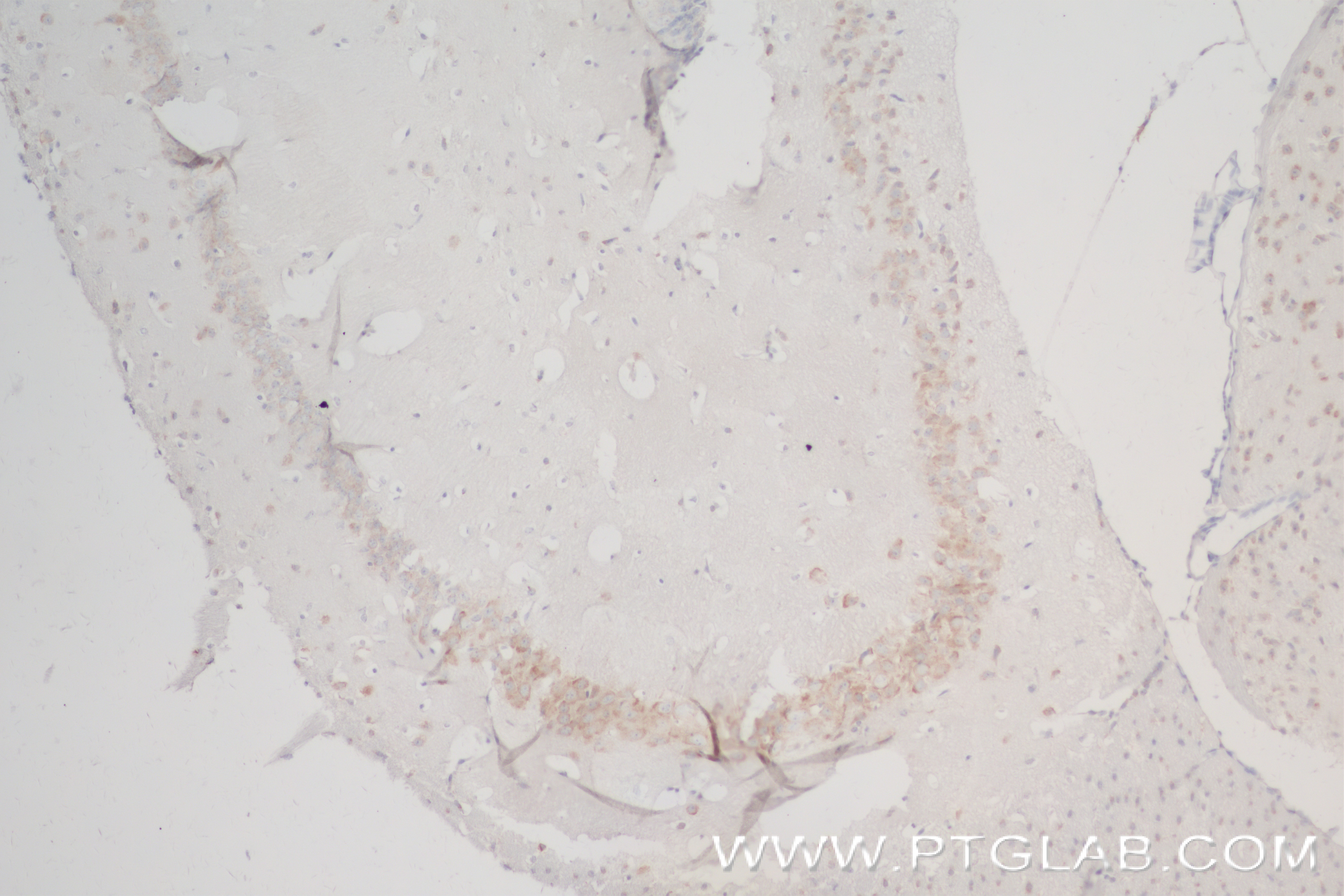 Immunohistochemistry (IHC) staining of mouse brain tissue using CCR8 Recombinant antibody (84545-1-RR)