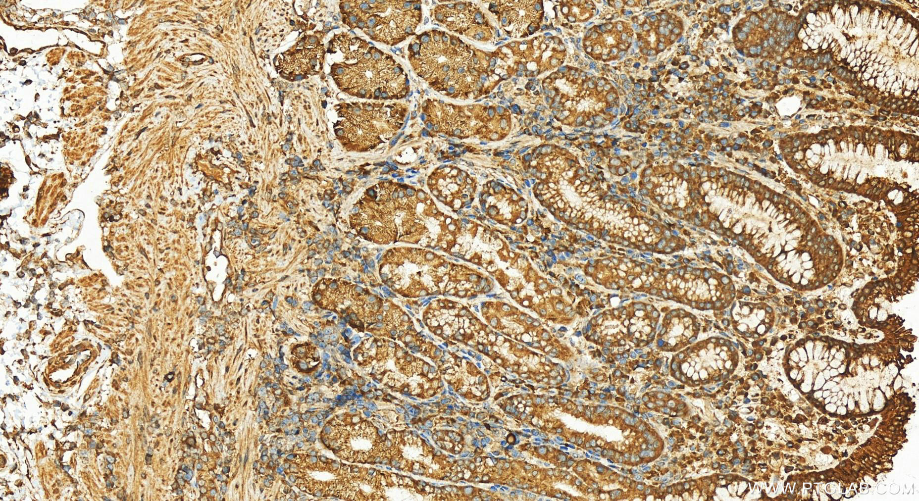 Immunohistochemistry (IHC) staining of human stomach tissue using CCT2 Polyclonal antibody (24896-1-AP)