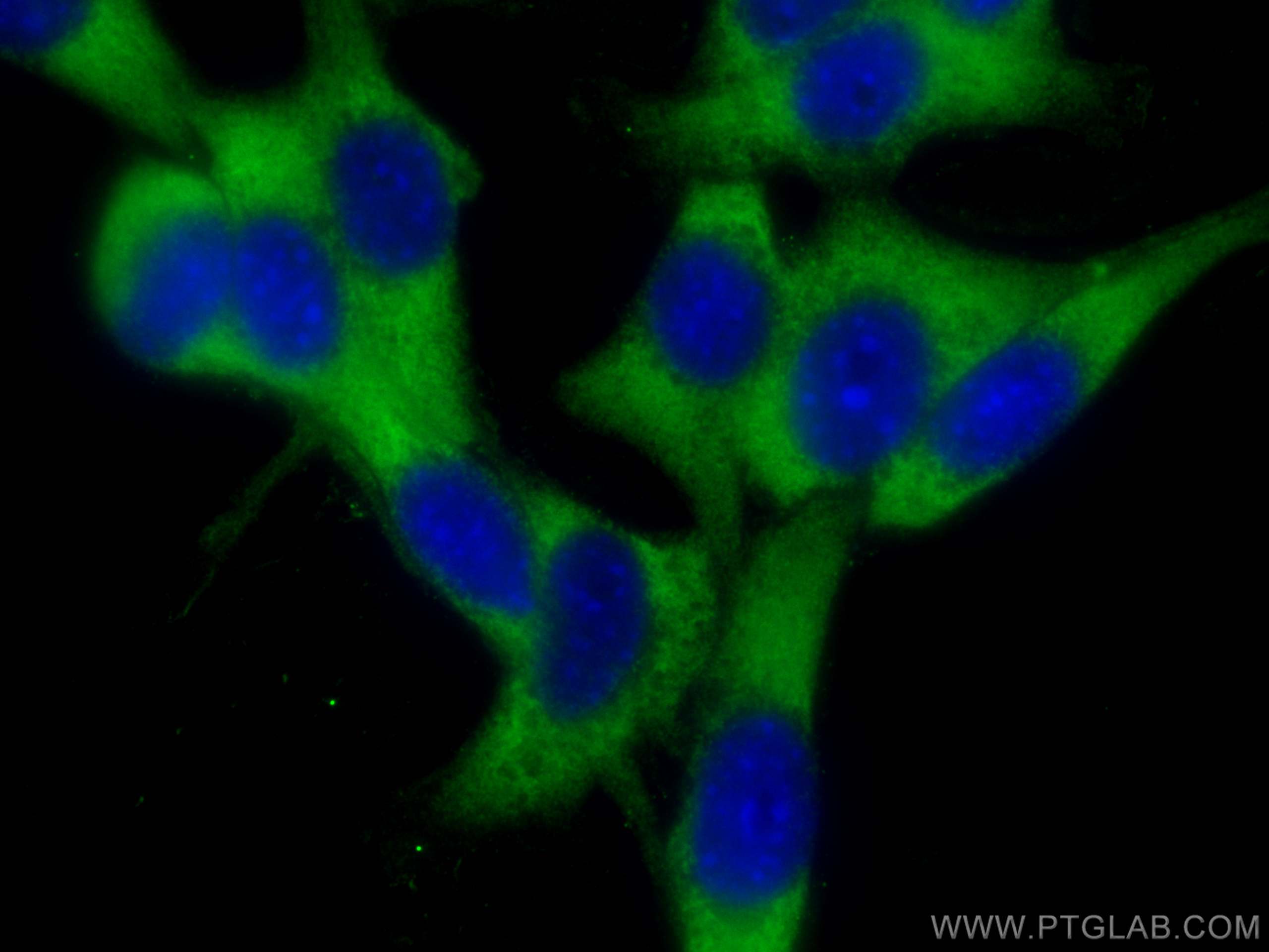 Immunofluorescence (IF) / fluorescent staining of NIH/3T3 cells using CCT2 Polyclonal antibody (24896-1-AP)