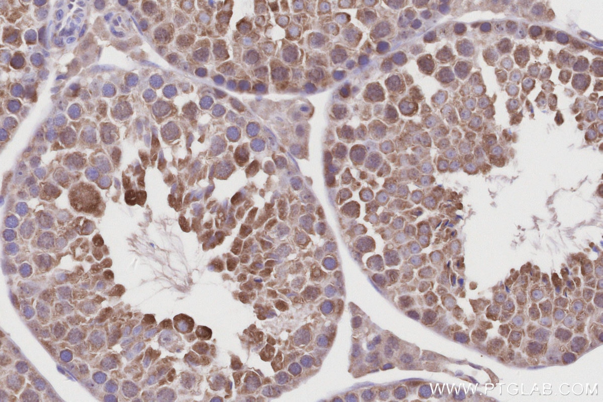 Immunohistochemistry (IHC) staining of mouse testis tissue using CCT4 Polyclonal antibody (21524-1-AP)