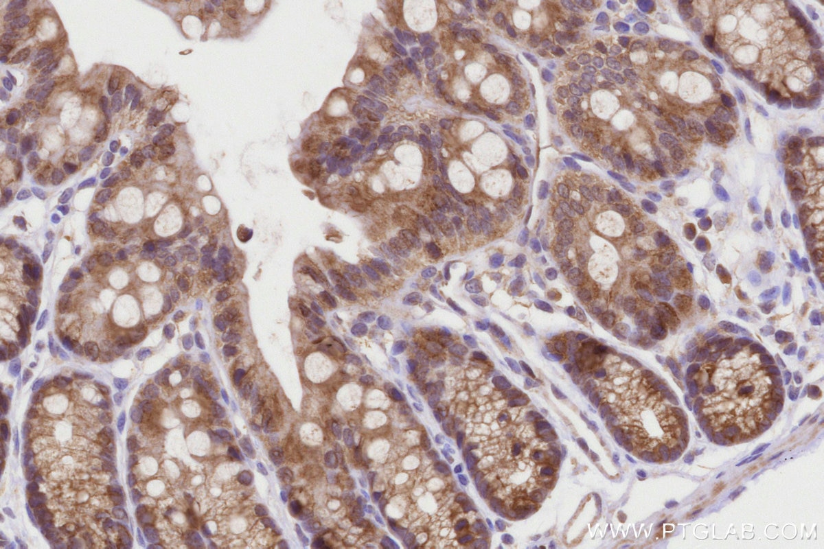 Immunohistochemistry (IHC) staining of mouse colon tissue using CCT4 Polyclonal antibody (21524-1-AP)