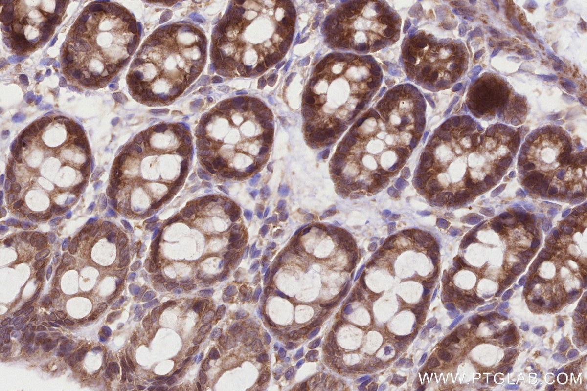 Immunohistochemistry (IHC) staining of rat colon tissue using CCT4 Polyclonal antibody (21524-1-AP)