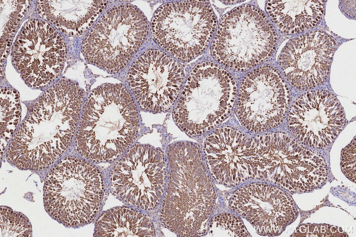 Immunohistochemistry (IHC) staining of rat testis tissue using CCT4 Polyclonal antibody (21524-1-AP)
