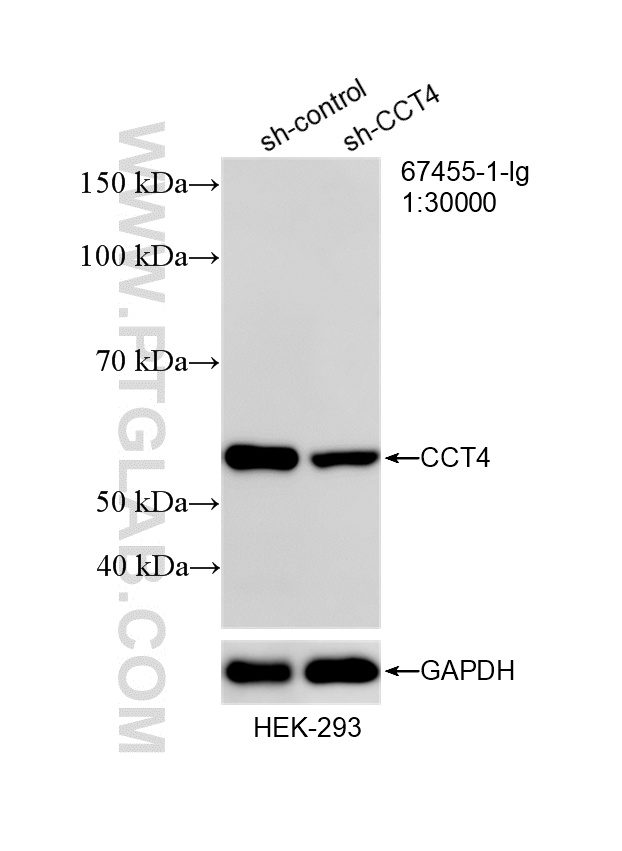 Western Blot (WB) analysis of HEK-293 cells using CCT4 Monoclonal antibody (67455-1-Ig)