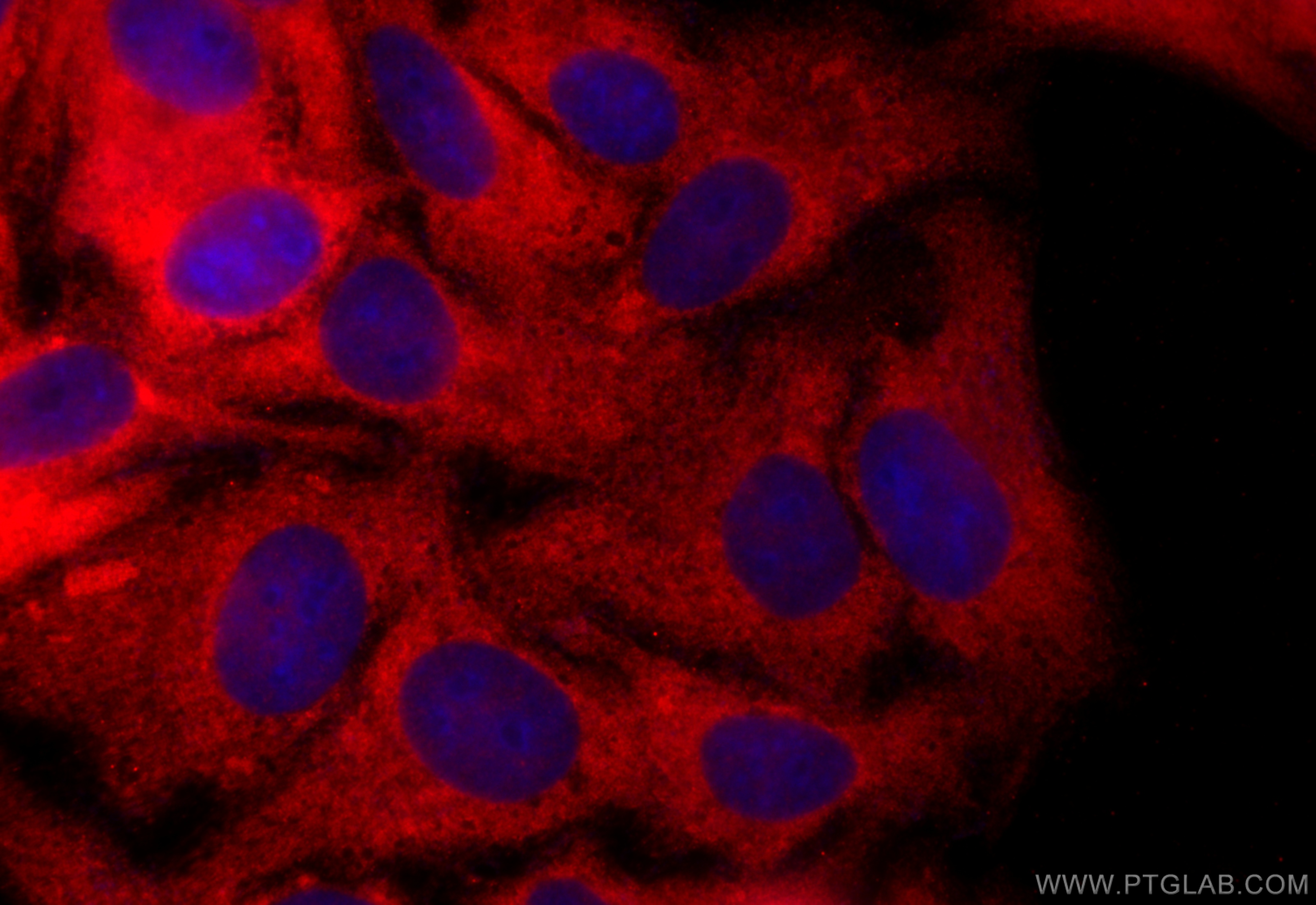 Immunofluorescence (IF) / fluorescent staining of HepG2 cells using CCT5 Polyclonal antibody (11603-1-AP)