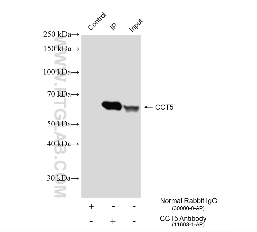 Immunoprecipitation (IP) experiment of HeLa cells using CCT5 Polyclonal antibody (11603-1-AP)