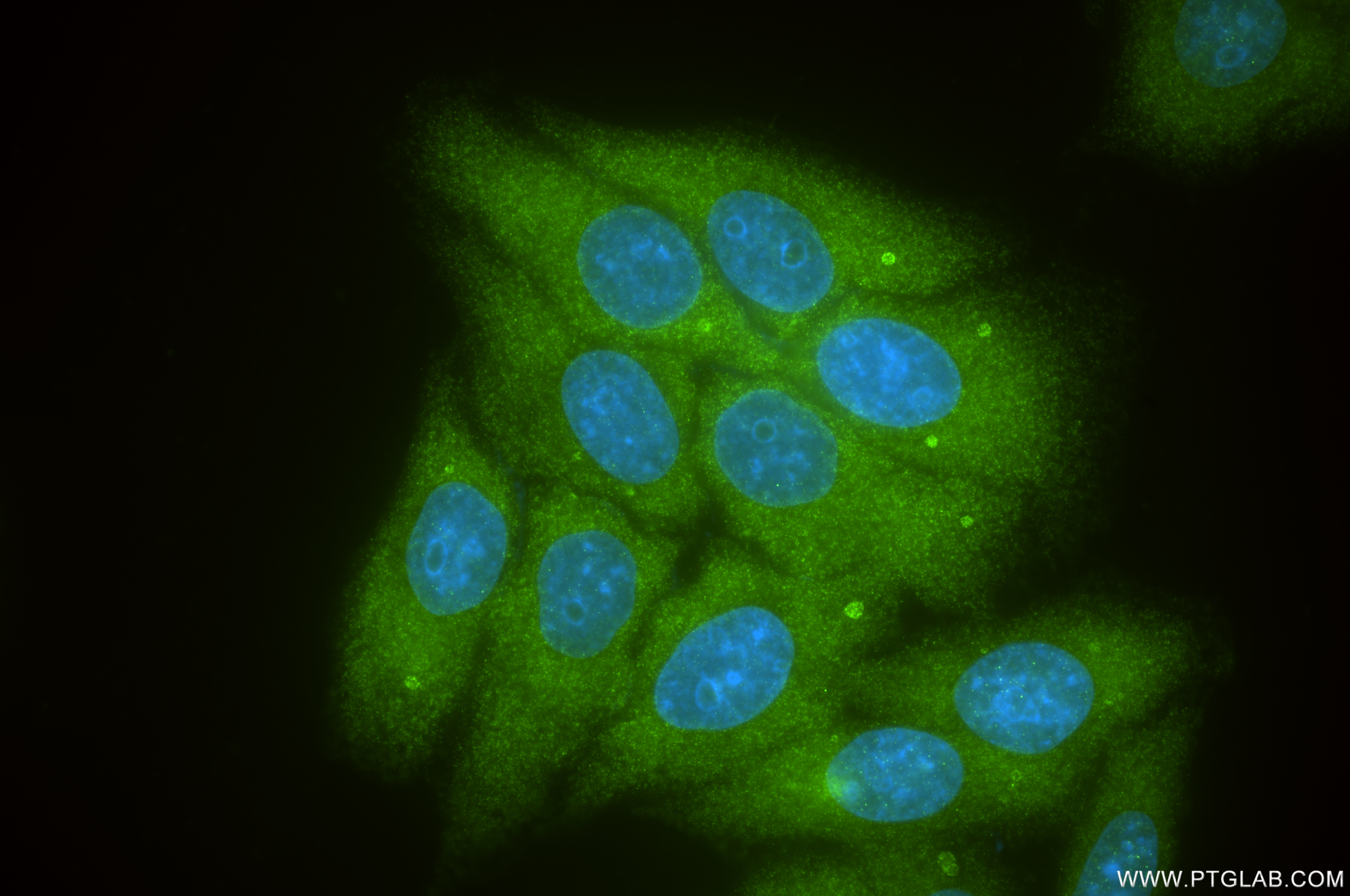 Immunofluorescence (IF) / fluorescent staining of HepG2 cells using CCT5 Recombinant antibody (84310-2-RR)