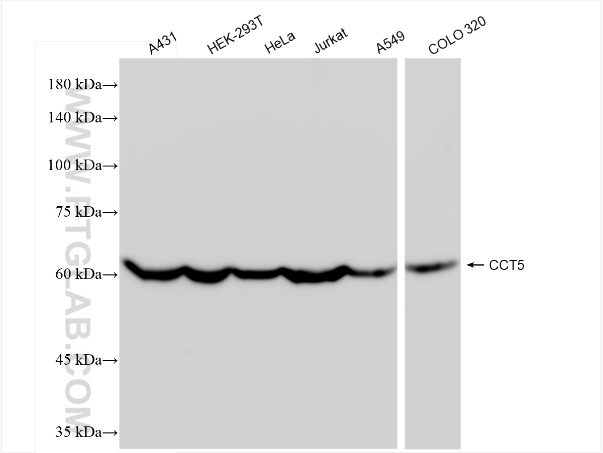 Western Blot (WB) analysis of various lysates using CCT5 Recombinant antibody (84310-2-RR)