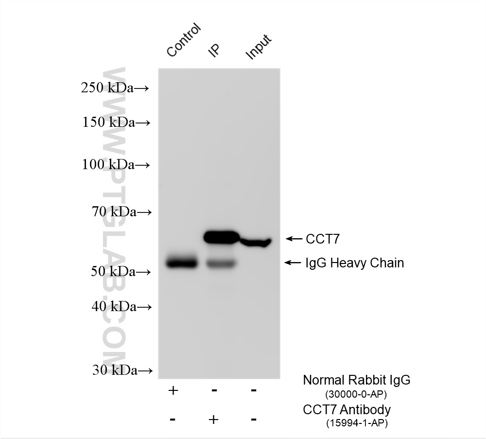 Immunoprecipitation (IP) experiment of HEK-293 cells using TCP1 eta Polyclonal antibody (15994-1-AP)