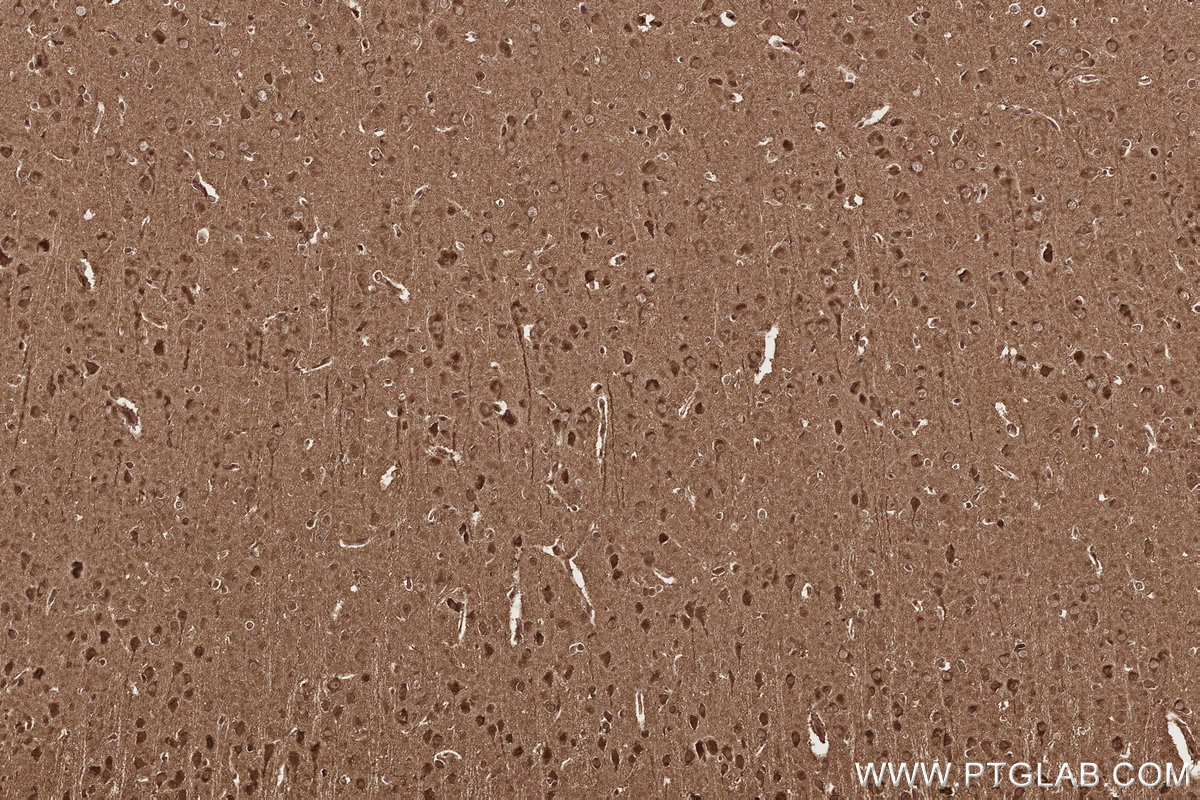 Immunohistochemistry (IHC) staining of rat brain tissue using CCT8 Monoclonal antibody (67539-1-Ig)