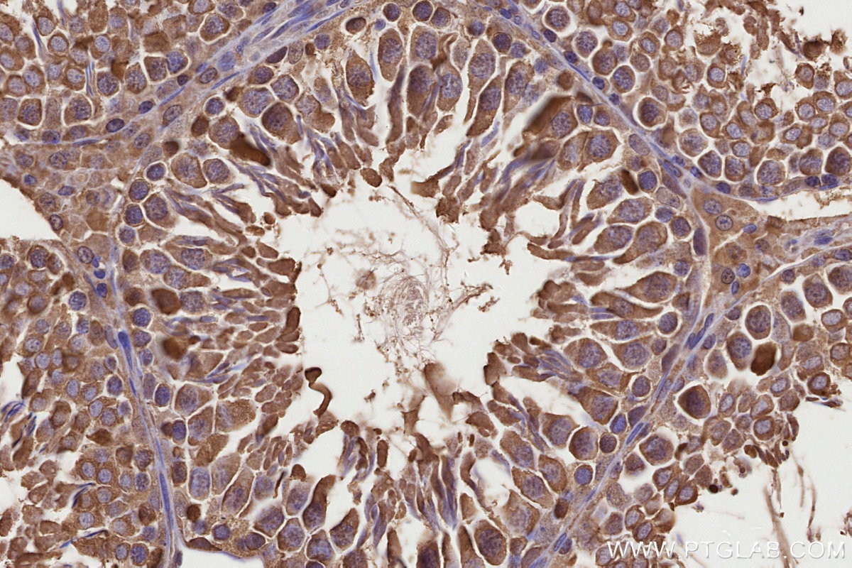 Immunohistochemistry (IHC) staining of rat testis tissue using CCT8 Monoclonal antibody (67539-1-Ig)