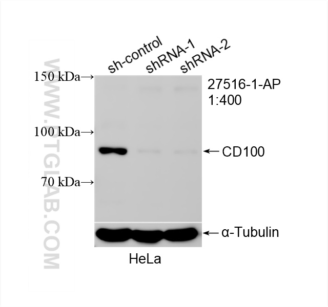 Western Blot (WB) analysis of HeLa cells using CD100 Polyclonal antibody (27516-1-AP)