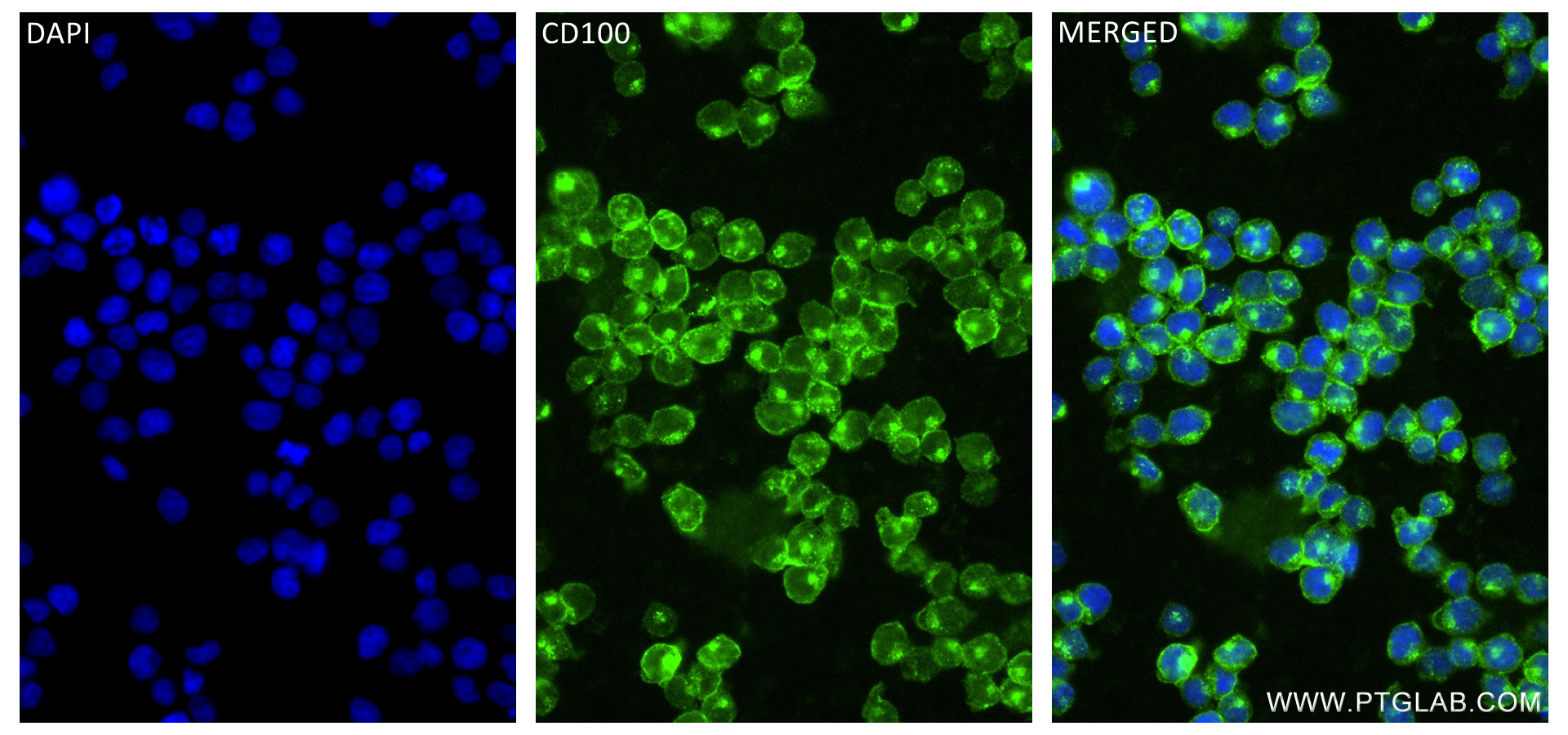 Immunofluorescence (IF) / fluorescent staining of Jurkat cells using CD100 Recombinant antibody (84465-4-RR)