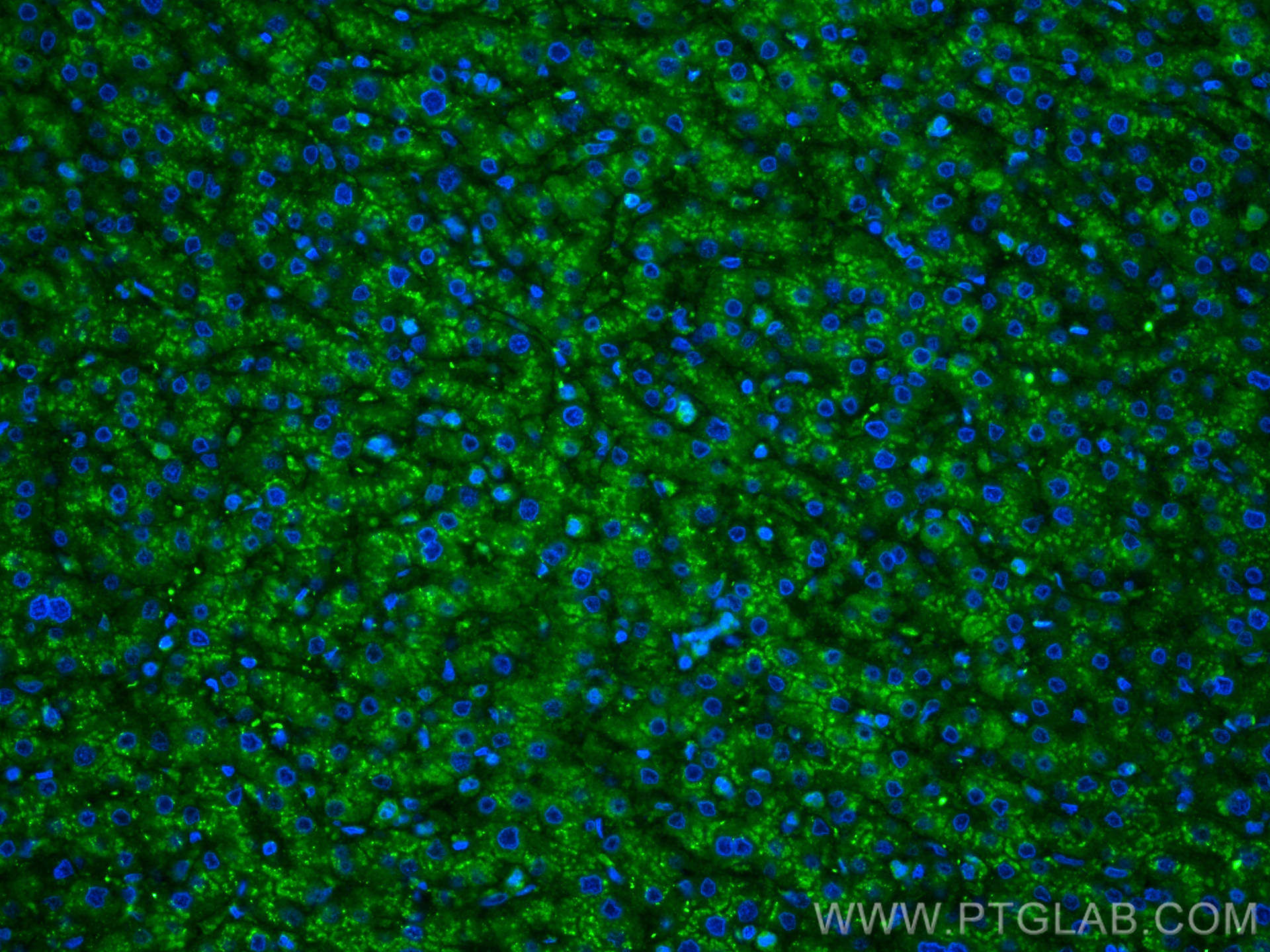 Immunofluorescence (IF) / fluorescent staining of human liver tissue using CD107a / LAMP1 Monoclonal antibody (67300-1-Ig)