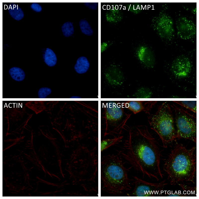 Immunofluorescence (IF) / fluorescent staining of HeLa cells using CD107a / LAMP1 Recombinant antibody (84658-5-RR)